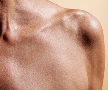 Visible Results On Targeted Areas