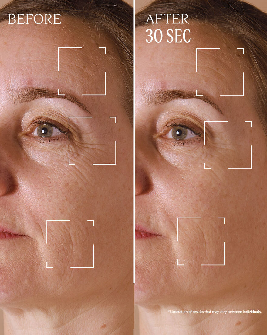view 7/9 of Immortelle Divine Targeted Wrinkle Care, , AURECT